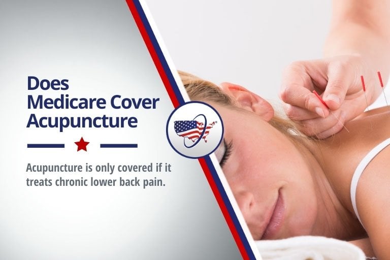 Does Medicare Cover Acupuncture